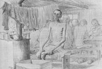 Dysenteri